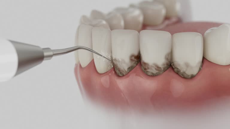 Trusted Teeth Cleaning And Checkup service in Claremont, NH - Dentist Open Now